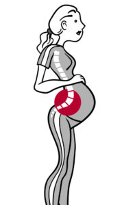 Anterior pelvic tilt during pregnancy. Planking during pregnancy